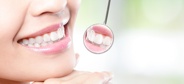 歯周病と定期検診